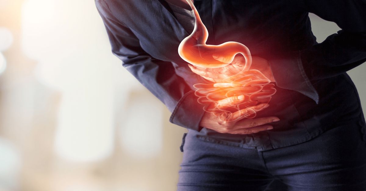 What Causes Large Intestine Cancer?