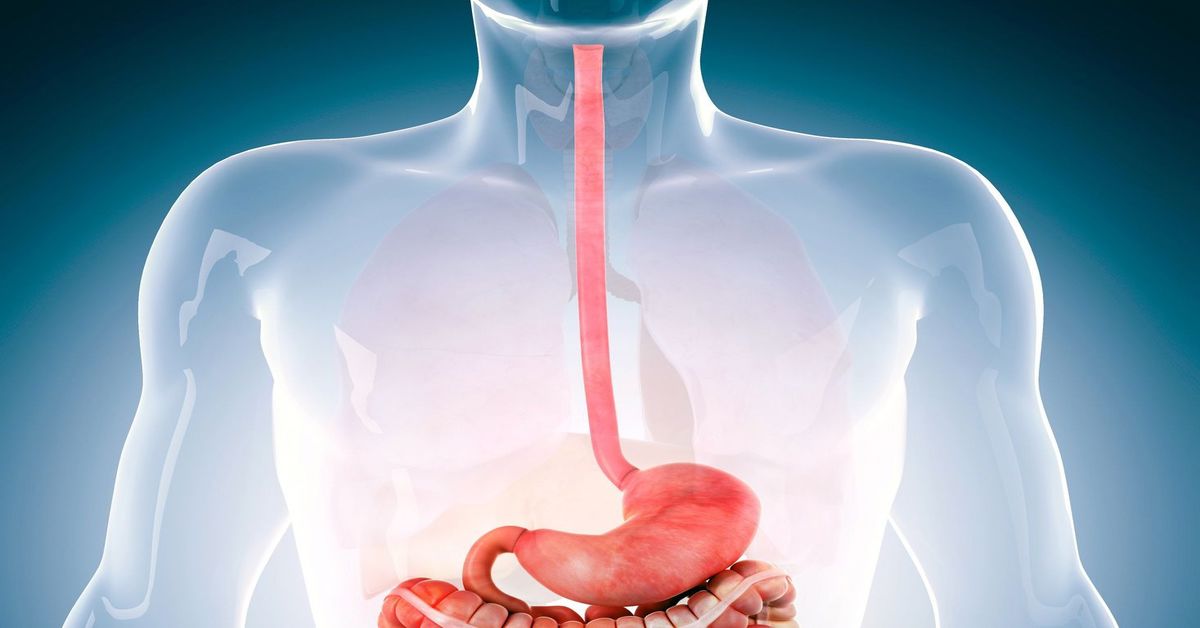 What Causes Esophagus Cancer?