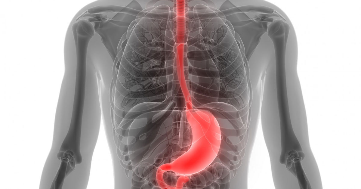 What Causes Esophagus Cancer?
