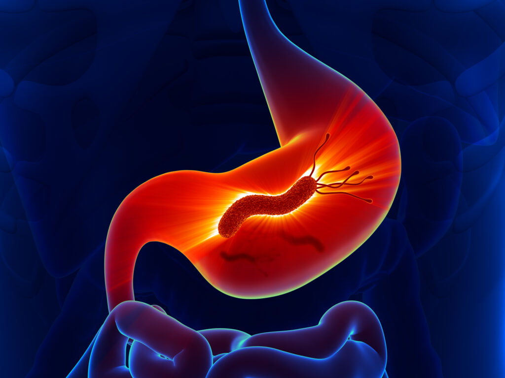 Chronic Gastritis Symptoms