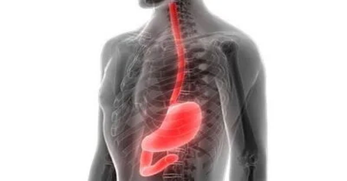 Yemek Borusu İltihabı