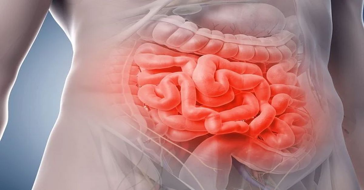 Bağırsak Enfeksiyonu