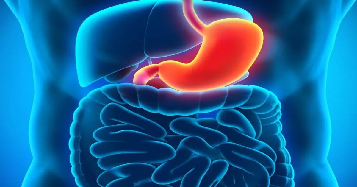 Mide İltihabı Ameliyatı